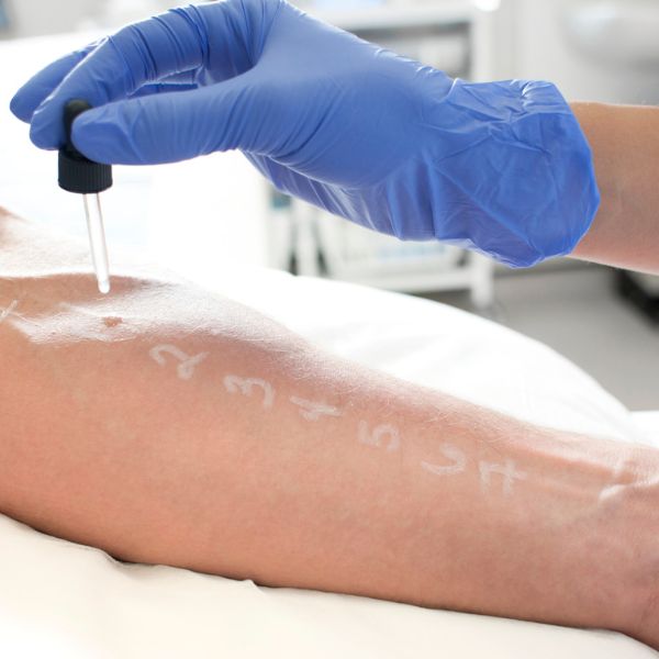 Importance of patch testing for allergic reactions to tattoo inks